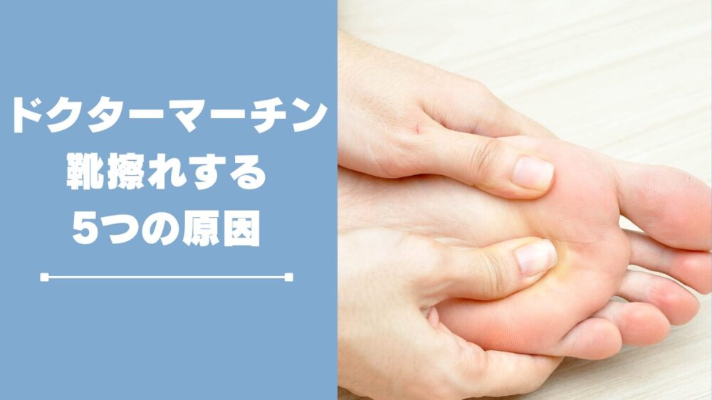 ドクターマーチンサンダルで靴擦れする原因５つ